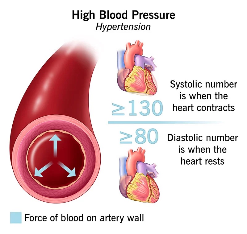 Leaders In Heart Care