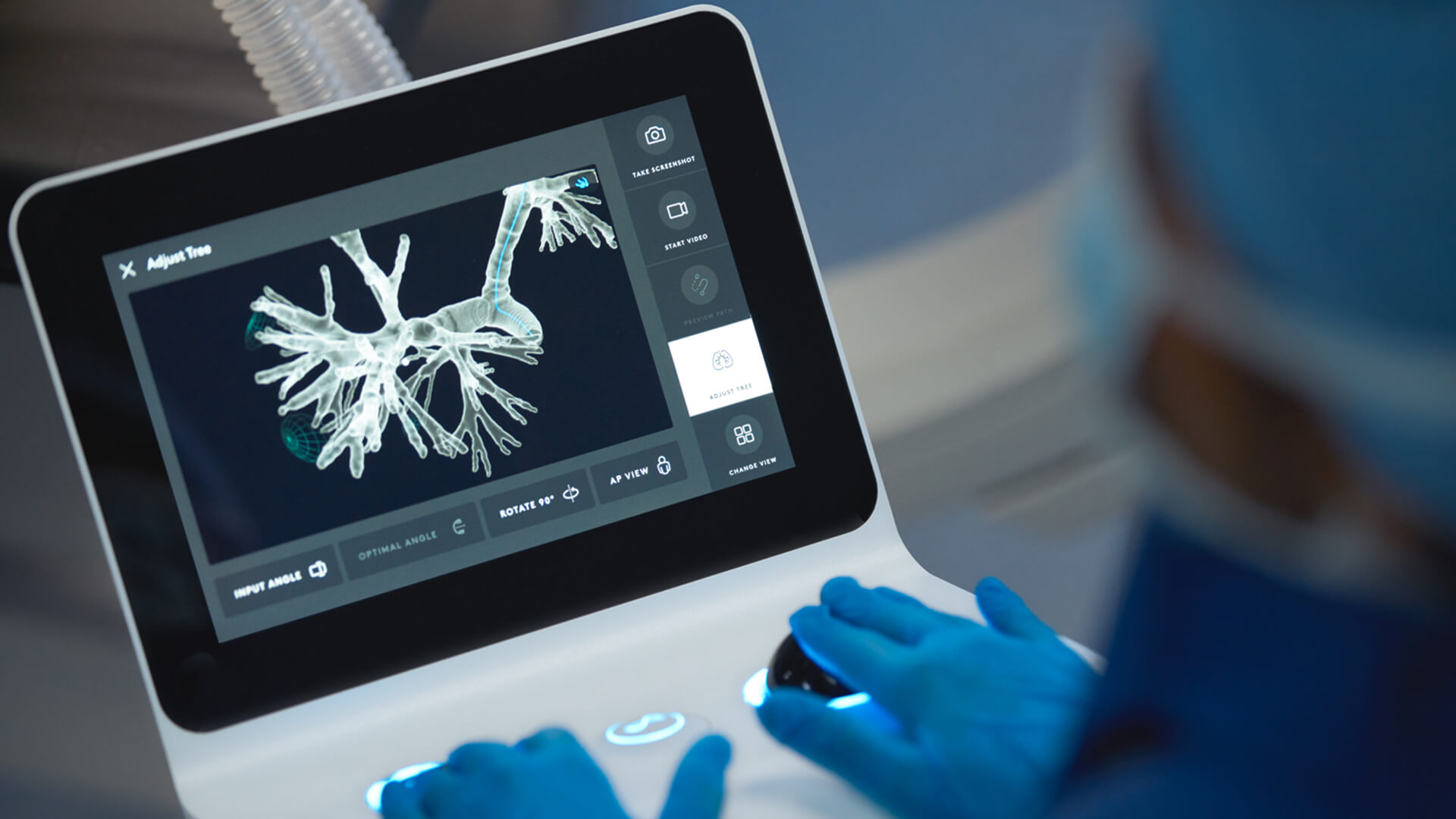 person using ion robot to examine bronchial tubes