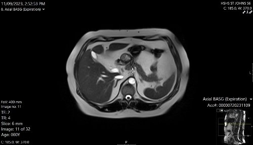 Image of Abdomen in Open MRI