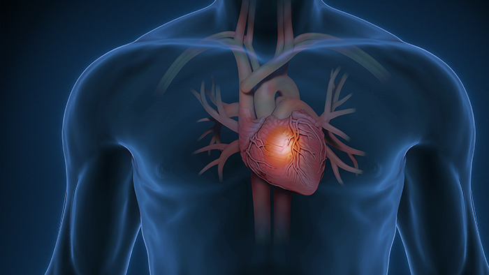 Structural Heart Disease